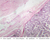 b81 tunica vaginalis 2x labeled.jpg
