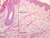a48 dermis 10x labeled.jpg