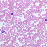 A100, Blood Smear, 40x (Wright)