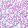 A100, Blood Smear, 40x Labeled (Wright)
