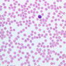 A100, Blood Smear, 40x (Wright)