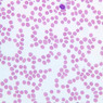 A100, Blood Smear, 40x (Wright)