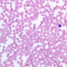 A100, Blood Smear, 40x (Wright)