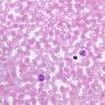 A100, Blood Smear, 40x (Wright)
