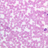 A100, Blood Smear, 40x (Wright)