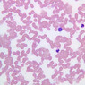 A100, Blood Smear, 40x (Wright)