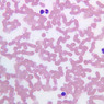 A100, Blood Smear, 40x (Wright)