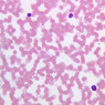 A100, Blood Smear, 40x (Wright)