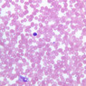 A100, Blood Smear, 40x (Wright)