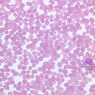 A100, Blood Smear, 40x (Wright)