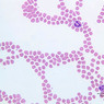 A100, Blood Smear, 40x (Wright)