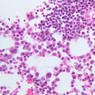 A4, Bone Marrow, 40x (H&E)