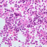 A4, Bone Marrow, 40x (H&E)