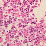 A4, Bone Marrow, 40x (H&E)
