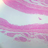 A28, Renal Artery (Kidney), 2.5x (H&E)