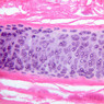 A75, Trachea, 10x (H&E)