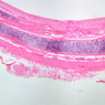 A75, Trachea, 2.5x (H&E)