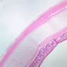 A76, Trachea, 2.5x (H&E)