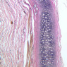 A51, Ear (Cartilage), 10x (Verhoeff)