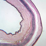 A51, Ear (Cartilage), 2.5x (Verhoeff)