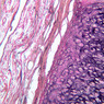A51, Ear (Cartilage), 10x (Verhoeff)