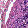 A51, Ear (Cartilage), 20x (Verhoeff)