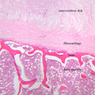 A3, Intervertebral Disk, 2.5x Labeled (H&E)