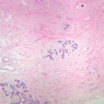 A93, Mammary, 2.5x (H&E)
