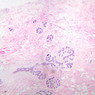 A93, Mammary, 2.5x (H&E)