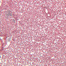 A34, Lymph Node, 20x (Reticulin)