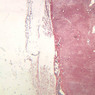 A34, Lymph Node, 2.5x (Reticulin)