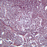 A34, Lymph Node, 10x (Reticulin)