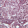 A34, Lymph Node, 20x (Reticulin)
