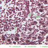 A34, Lymph Node, 40x Labeled (Reticulin)