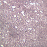 A37, Spleen, 10x (Reticulin)