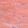 A19, Myotendinous Junction, 40x (PTAH)