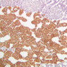 B61, Adrenal Gland, 10x (Chromaffin)