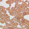 B61, Adrenal Gland, 20x (Chromaffin)