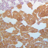 B61, Adrenal Gland, 20x (Chromaffin)
