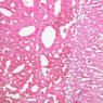 B62, Adrenal Gland, 10x (H&E)