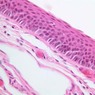 A67, Trachea, 20x (H&E)