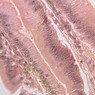 B14, Intestine, 40x (Fe)