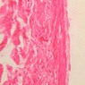 Epithelium