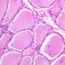 Epithelium