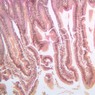 Epithelium