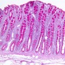 Epithelium