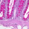Epithelium
