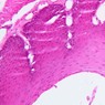 Epithelium