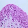 Epithelium