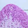 Epithelium